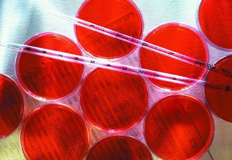 Spectra/ Por? Dialysis Membrane